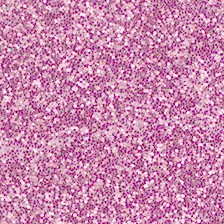 Moosgummiplatte Glitzereffekt, 20 x 30 cm, pink, Ø 2 mm
